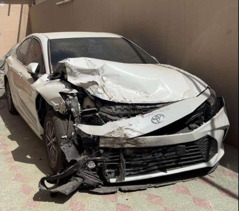 شراء الصينية المصدومة